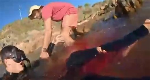 Matteo Mariotti attaccato da uno squalo in Australia: «Con il video volevo dirvi addio, non avrei mai pensato di poter sopravvivere a quel mostro»