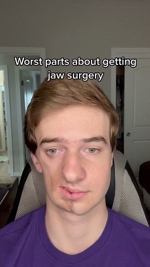 Recovery Journey After Jaw Surgery
