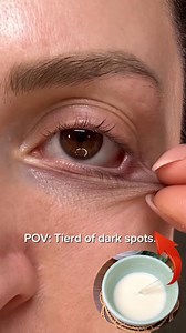 524K views · 3.2K reactions | Banish Dark Circles in Days! ✨ #Reels | Natural Beauty Recipes | Facebook
