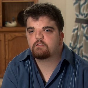 ''My Surgeries Have Cost Over $2 Million'' Can the Botched By Nature Drs. Help a Man Who Was Born With a ''Hole'' in His Heart?