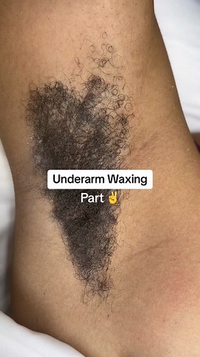 Underarm waxing! Watch how I execute these bushy underarm with waxing. This is 3 months of growth! Bushy hair needs a thick coat of wax. Let me know in the comments if you want to see the pull!!!! #underarmwax #underarmwaxing #hawaiiwaxing #waxingvideos #hawaiiwaxer #waxingunderarms