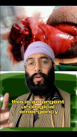 Testicular Trauma | Haemorrhage | Rupture #testicularinjury #urology #surgery