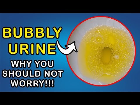 BUBBLES IN URINE: Why you don't need to worry