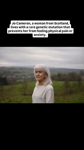 Jo Cameron, a woman from Scotland, lives with a rare genetic mutation that prevents her from feeling physical pain or anxiety. She once burned her hand on a hot stove and only realized it when she smelled her skin burning. Doctors discovered that her body naturally produces elevated levels of endocannabinoids-compounds that suppress pain and stress. #Reels #ReelsInstagram#ReelItFeelIt #InstaReels #ExplorePage #ReelsTrending #ViralReels #reelsdaliy #ReelsOfInstagram #InstagramReels#FYP #TrendingN