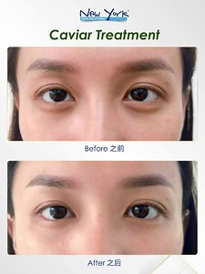 What is a Caviar Treatment? What does it do? 💠Stimulate Collagen Growth 💠Regenerate cells 💠Brighten skin tone 💠Firm & reduce wrinkles 💠Increase elastin 💠Prevent wrinkles 💠Anti-inflammation & soothe Using Green Caviar as it’s main ingredient ✅Deep Penetration ✅Micro-molecule ✅Lightweight ✅Strong absorption Want to know more?? Join us at our FB Live with Amber Chia to WIN RM12800 worth of 🎁🎁prizes: 10x Caviar Treatment Package. 📅Date: 14/6/2021 (Monday) ⏰ Time: 9.30pm 📲 Page: www.facebo