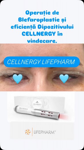 🔥Cellnergy LifePharm – Tehnologia Revoluționară pentru Activarea Celulelor Stem la Domiciliu 💥Descoperă Cellnergy Wellness, dispozitivul inovator creat de LifePharm, care combină știința avansată cu tehnologia de vârf pentru a sprijini regenerarea celulară și sănătatea generală. Acesta utilizează unde terahertz, terapie cu lumină roșie și căldură controlată pentru a stimula activitatea celulară, favorizând repararea țesuturilor și revitalizarea organismului. 🔬 Cum funcționează Cellnergy Welln
