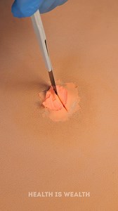 128K views · 54 reactions | Pus Removal and Stitching Procedure | Health is Wealth | Facebook