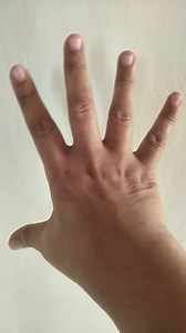 124K views · 1.1K reactions | Hands Therapy Exercise for Hand Arthritis #HandTherapy #handtherapist #postviralシ2025 #everyoneactivefollowersシfypシ゚viralシalシ #healthcare #bodycare #memory #arthritis #arthritisrelief #motivation #health #Exercise #1millionviews | Ana Marie Delos Santos | Facebook