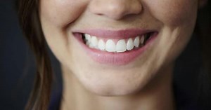 Face, smile and teeth with woman and dental zoom, oral care and healthcare for mouth for healthy