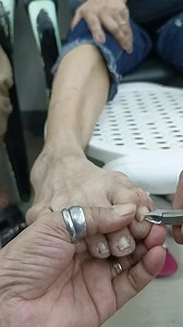 658K views · 2.7K reactions | Hila nya hila ko din paa nya super sakit kasi pero need talaga tanggalin #fypシ゚viralシfypシ゚viralシalシ #fbreelsfypシ゚viralシ #reelsvideoシ #facebookreelsviral #FacebookPage #ContentMonetization #allaroundnanay | All Around Nanay | Facebook