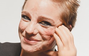 Paralympian Bebe Vio Isn’t Hiding Her Disability — Or Her Scars - FASHION Magazine