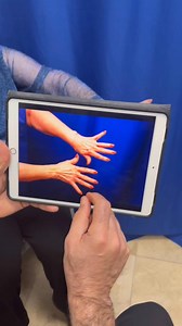 Dr. Khoobehi works wonders with fat transfer to restore youthful hands! Check out these stunning results in reducing the appearance of aging, leaving hands looking smoother and more rejuvenated. 🥰✨ | Dr. Kamran Khoobehi