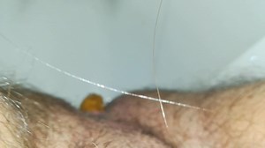 Poop and toilet flush