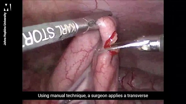 Robot performs keyhole surgery on pig without human help for first time