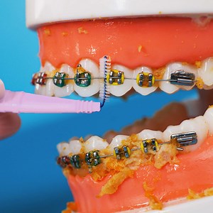 139K views · 237 reactions | Follow these hygiene tips for your good oral health! | 5-Minute Crafts Family | Facebook