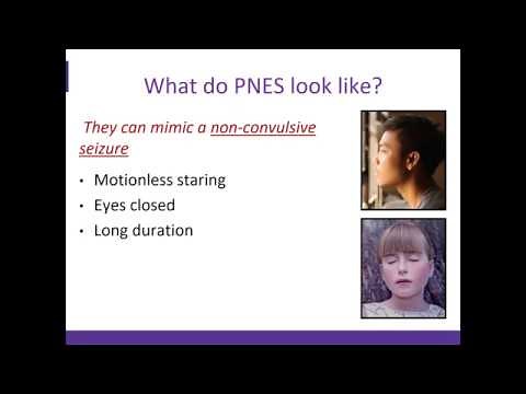 An Overview of Psychogenic Non Epileptic Seizures (PNES)
