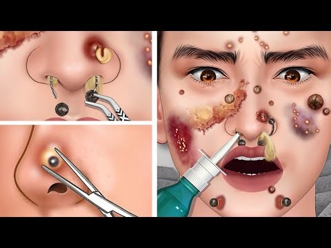 ASMR Treatment for Allergic Nose Piercings, Deep Cleansing Treatment