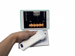 [Hot Item] Wireless Linear Array Ultrasound Probe USB Linear Ultrasound Transducer Msk Ultrasound Scanner