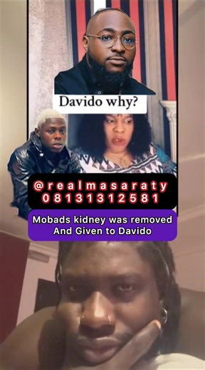Mobads kidney was removed and given to Davido. Why? | Realmasaraty