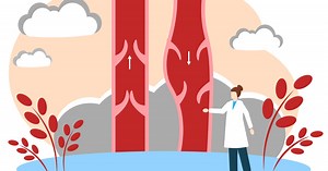 Preventing phlebitis: 15 actions to avoid it – Archyde
