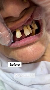 22K views · 254 reactions | 03159877381 WhatsApp no | Dentist Sameen Khan | Facebook