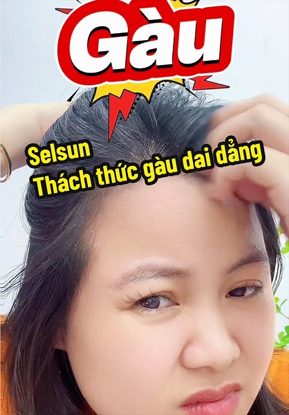 Selsun trị gàu dai dẳng hiệu quả