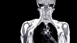 Woman had orgasm inside MRI scan machine to show what happens