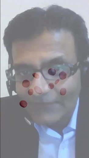 CCD Guideline - Antiplatelet Therapy