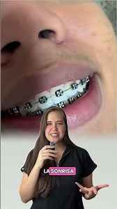 Rating black braces rubber bands🖤 #braces #dentist #viral #orthodontics