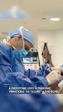 Gender Affirming Surgery - 360 Lipo & BBL with Rib Remodeling! Before & After Results!