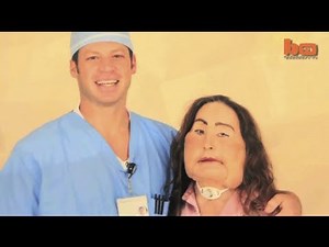 Face Transplant Patient Connie Culp 2 Years After Her Revolutionary Surgery