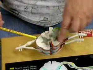 Upper Motor Neuron Lesion