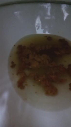 korean girl diarrhea - video 6