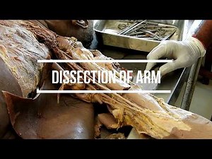 Dissection of Arm