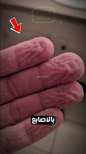 لماذا يحدث هذا؟😨💀