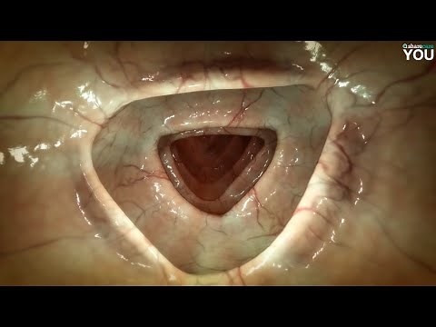 A Closer Look at the Digestive Tract