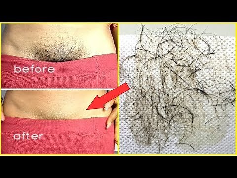 In Just 5 minutes Remove Pubic Hair Permanently |No Shave No Wax |Remove Private Part Hair Naturally