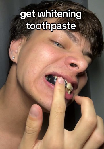 How to Whiten Teeth at Home Naturally