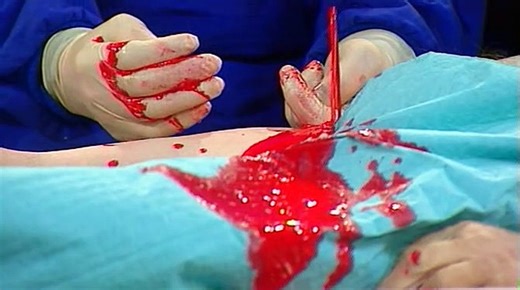 Autopsy Emergency Room - Minutes from Death