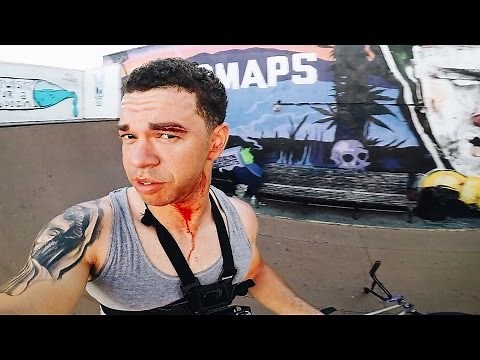 The Worst BMX Crash Of My Entire Life..