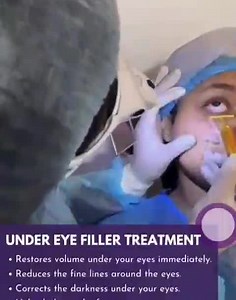 20 reactions | Dark circle treatment by filler  | Dr Tazrin Alam Mithila | Facebook