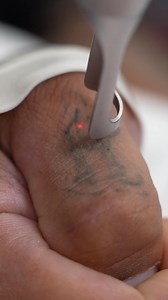 8.6K views · 27 reactions | When your tattoos are bad for your relationships, we've got you. With Laser Tattoo Removal by LaserAway, you can expect dramatic results with multiple sessions and uniform, natural results. Perfect for a fresh start! #exestattoo #unwantedtat #drunktattoo | LaserAway | Facebook