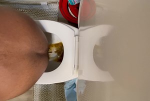 Diarrhea explosion - video 25