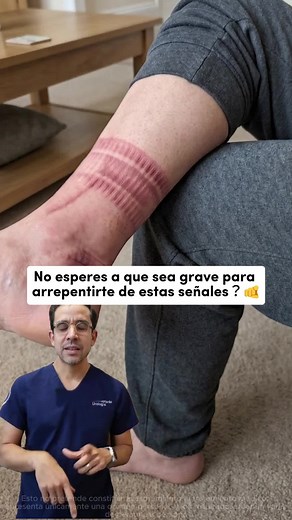 Orina espumosa y cara hinchada: ¿puede ayudar el aceite de semilla de calabaza?