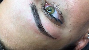 DermaFusion on Reels