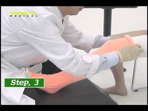 Long Leg Cast Application