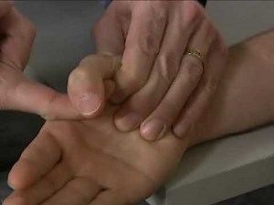 MMT Group Thumb Metacarpophalangeal (MCP) joint Flexion