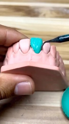 67K views · 5 comments | By @dental_labss 醴#teeth#tooth#toothless#extraction#cirugiabucal#oralsurgery#dental#dentist#dentistry#dentalhygiene#dentalassistant#dentalschool#dentalstudent#dentalhygiene#implant#dentist#odonto#odontogram#odontologo#odontolove#odontología#odontologia#odontogram#odontoporamor#estomatología#prosthesis#prosthodontics#ortho#braces#smile#drawing | Dentistry blog | Facebook