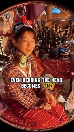 Does the giraffe woman die when she removes the brass ring from her neck?#retro #history