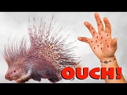 Porcupine Quills Human Hand! (and How to Remove Them)